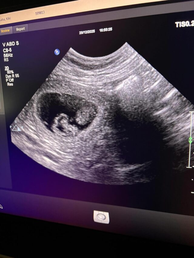 Puppies on their way🧸🐾❤️
Happy New Year!#laislasaustralianlabradoodles #australianlabradoodlesofinstagram #australianlabradoodlepuppies #wala #walapuppies